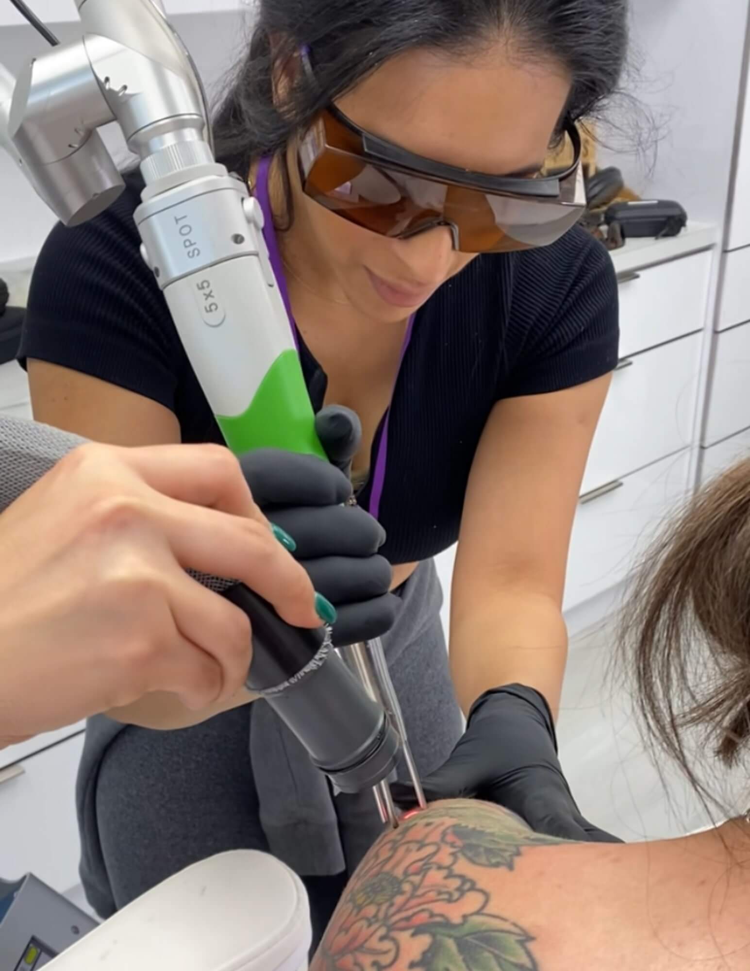 Laser tattoo removal Fort Lauderdale